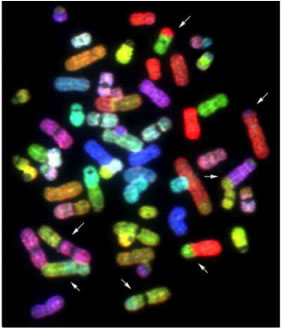 A Human Genome Stained by Fluourescent in Situ Hybridization